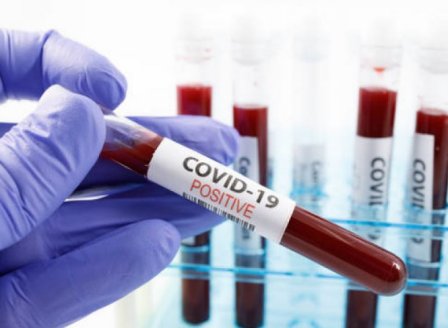 Новите случаи на коронавирус са 208